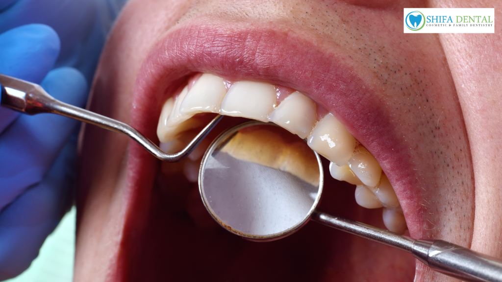 oral exams in Garland TX