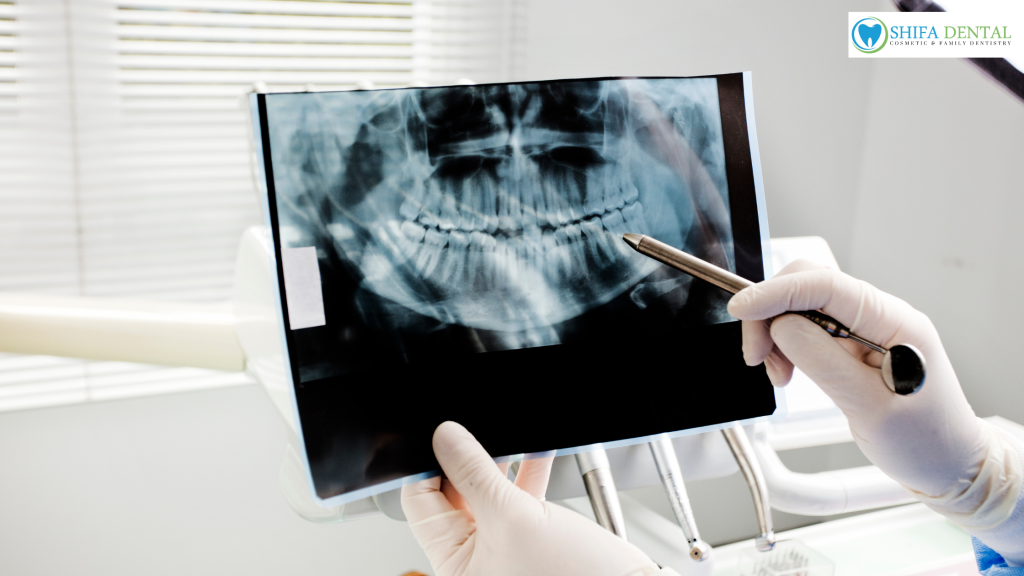 oral exams in plano tx
