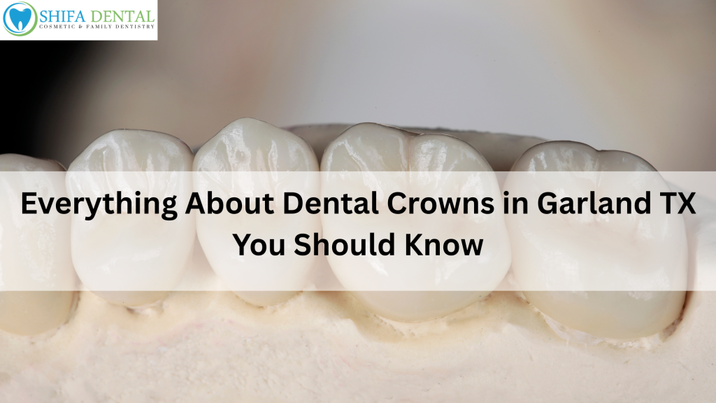 Dental Crowns in Garland TX