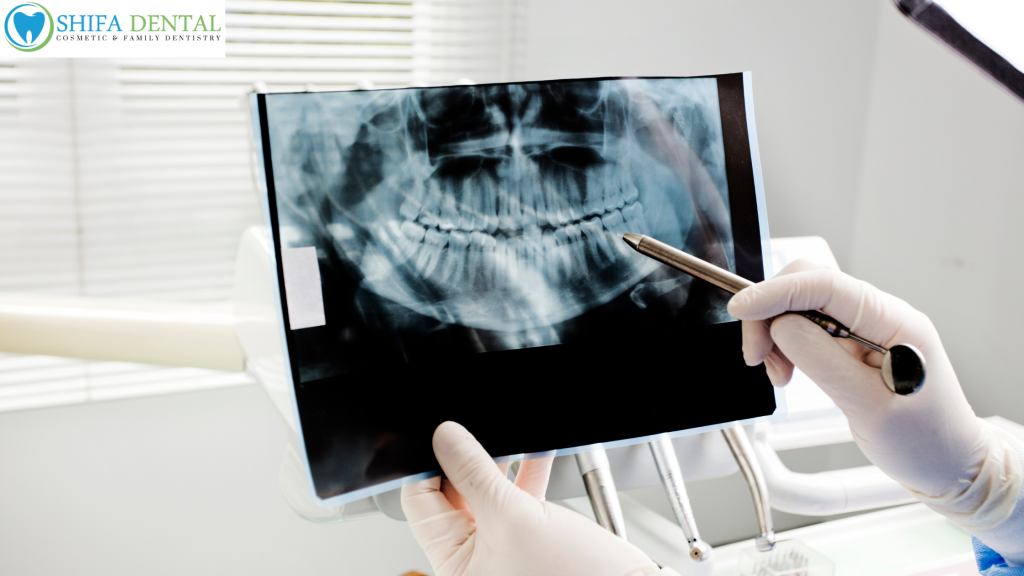 Dental X-Rays in Garland TX