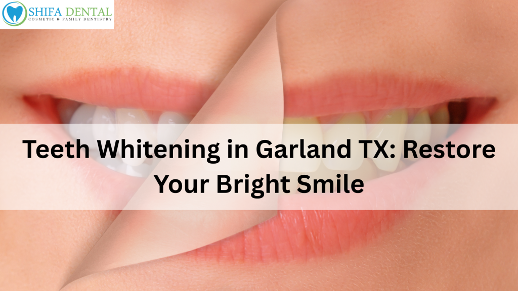 Teeth Whitening in Garland TX