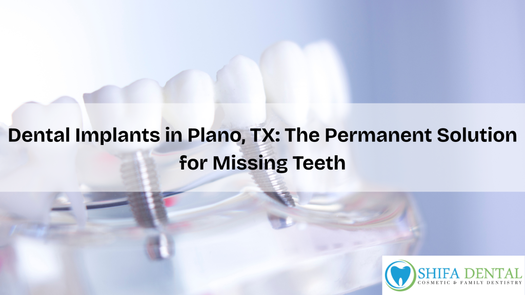 Dental Implants in Plano, TX