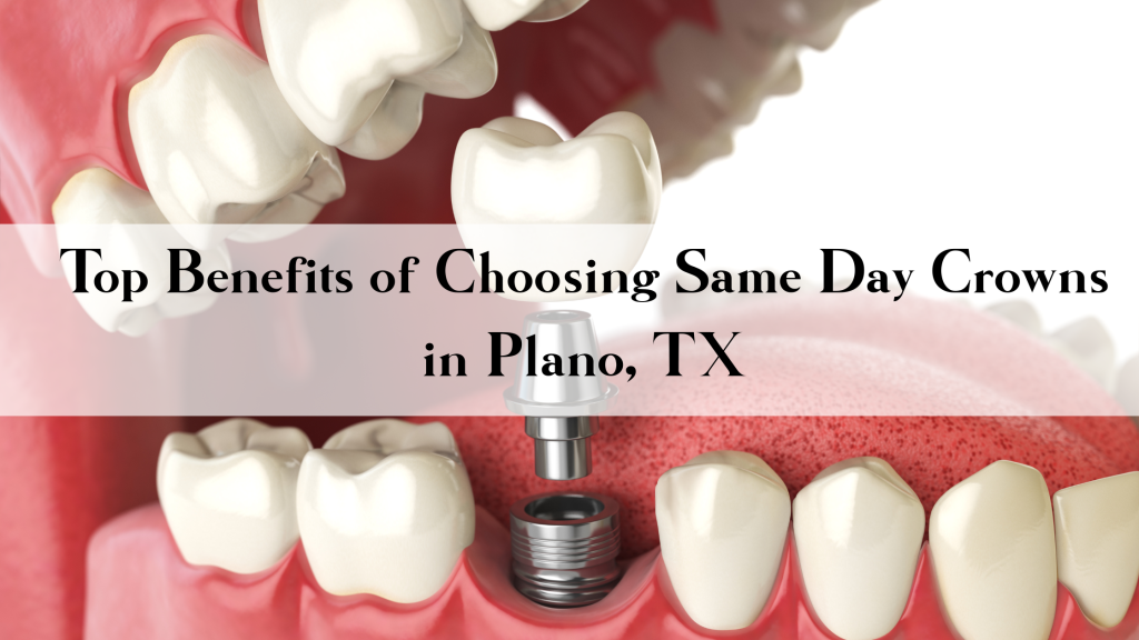 Same Day Crowns in Plano, TX