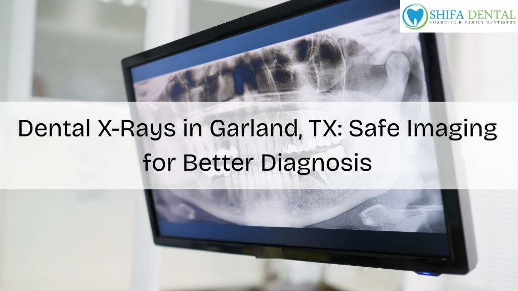 Dental X-Rays in Garland TX