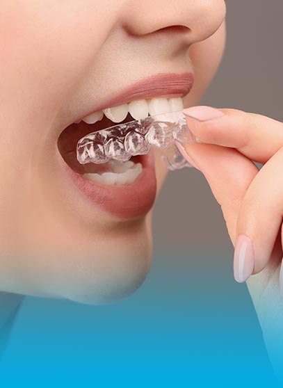 I-want-Invisalign®-Aligners