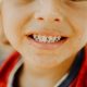 Are Cavities Contagious?
