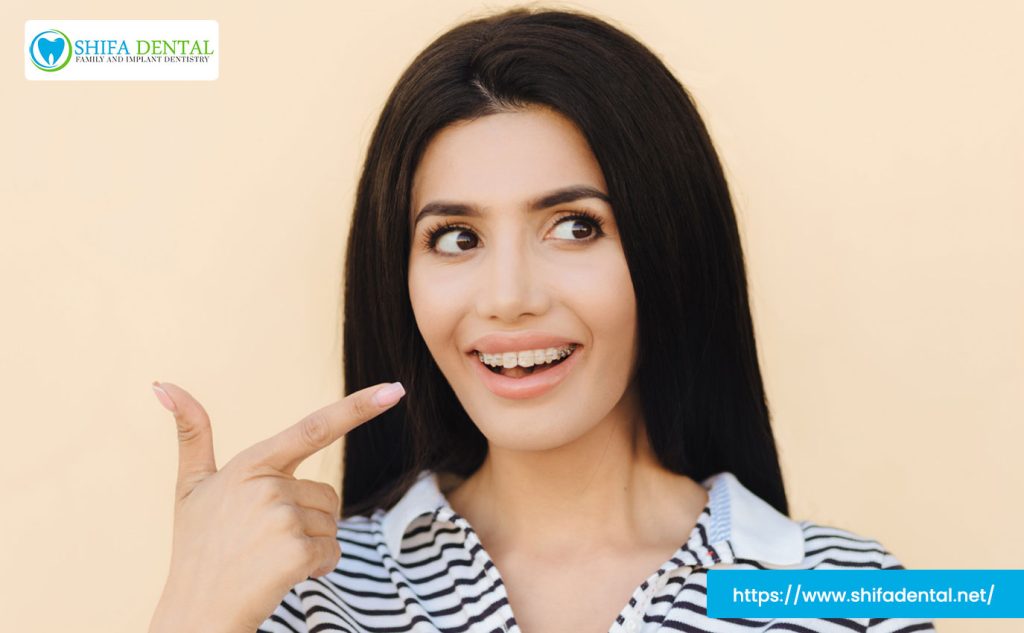 tooth-whitening-near-me