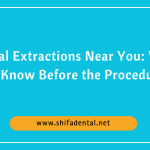 Dental Extractions Near You