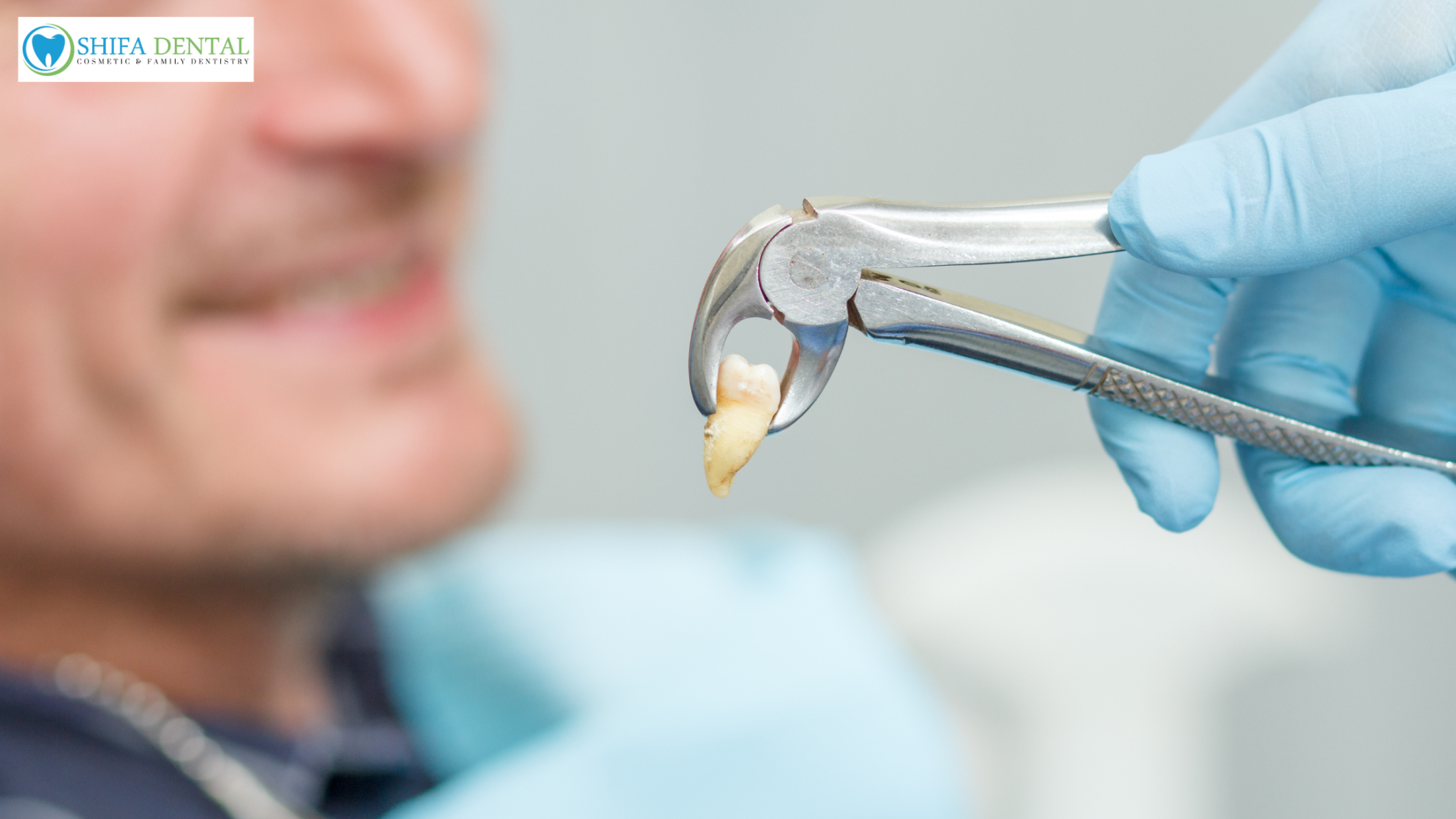 Dental Extractions in Plano