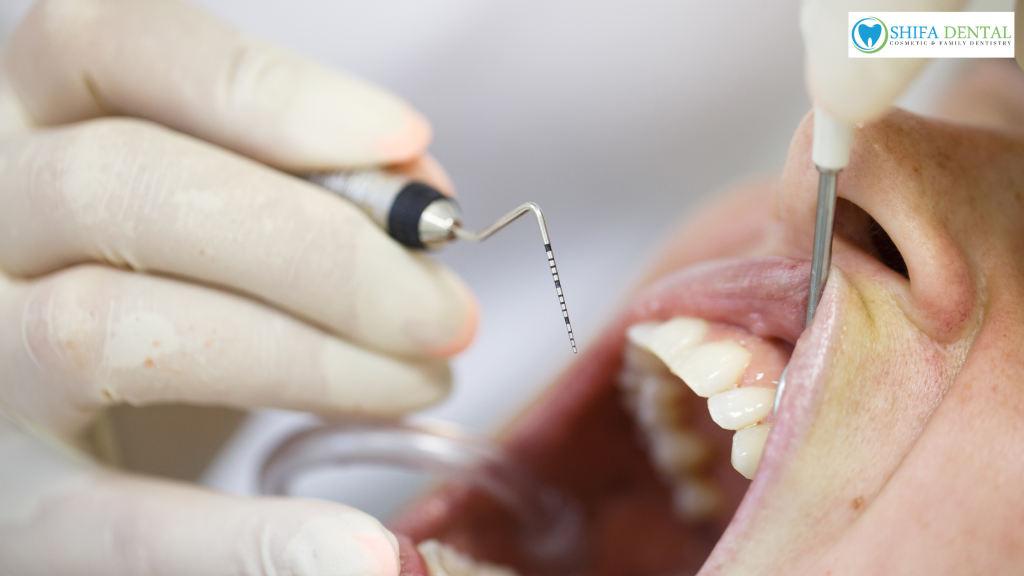 periodontal therapy in plano tx