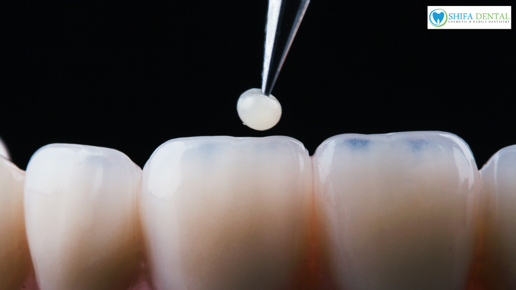restorative dentistry in Garland TX