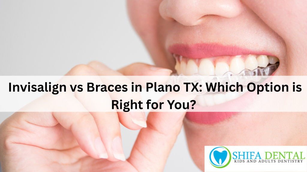 Invisalign vs Braces in Plano TX: Which Option is Right for You?
