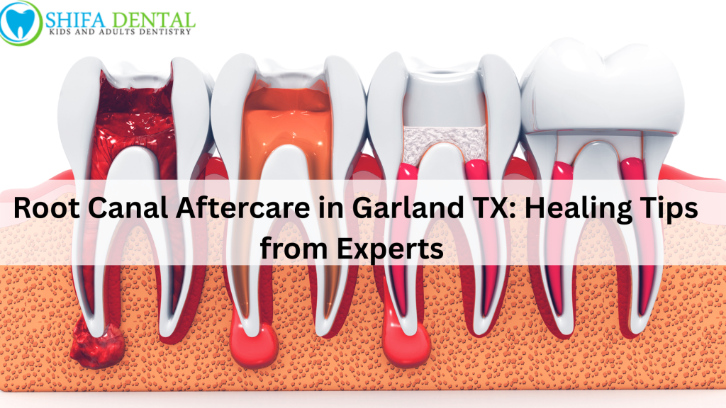 Root Canal Aftercare in Garland TX: Healing Tips from Experts