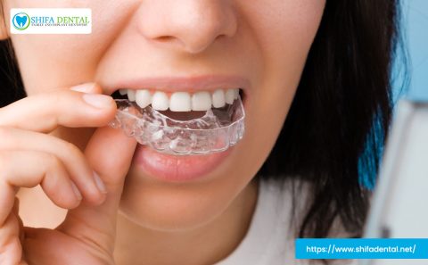 invisalign-vs-braces-plano
