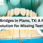 Dental Bridges in Plano, TX