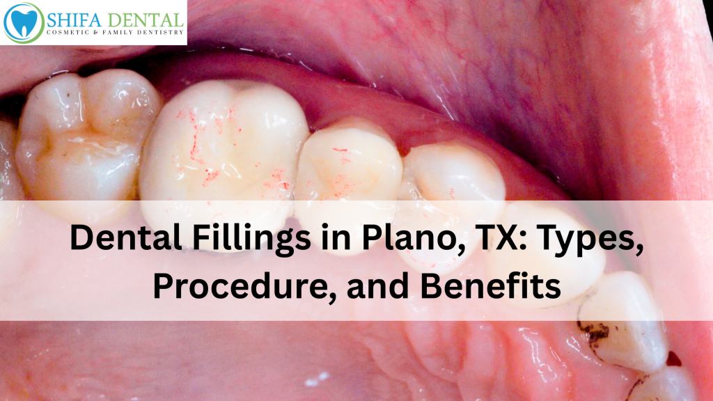 Dental Fillings in Plano, TX