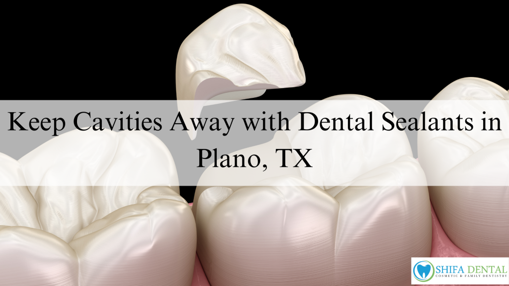 Dental Sealants in Plano, TX