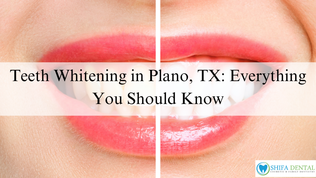 Teeth Whitening in Plano, TX