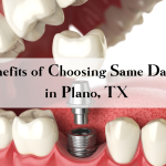 Same Day Crowns in Plano, TX