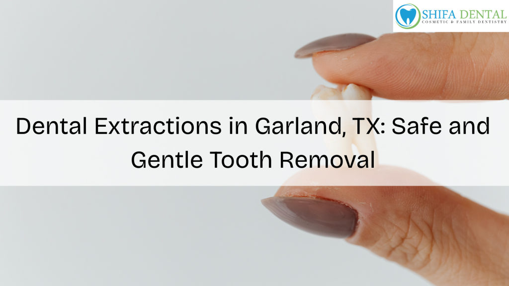 Dental Extractions in Garland TX