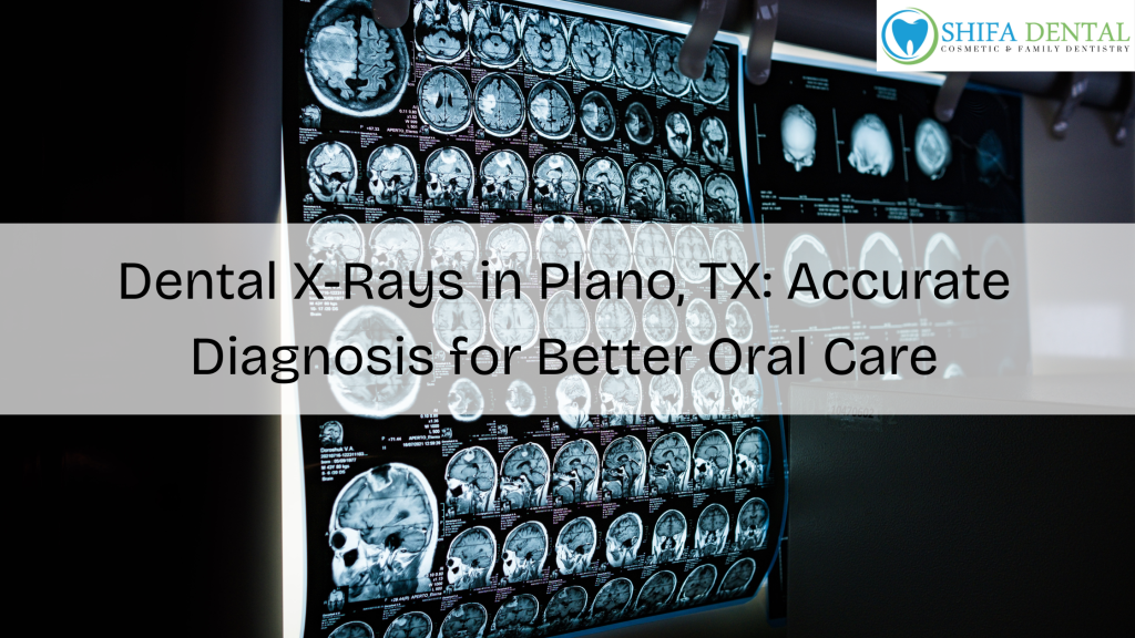 Dental X-Rays in Plano TX