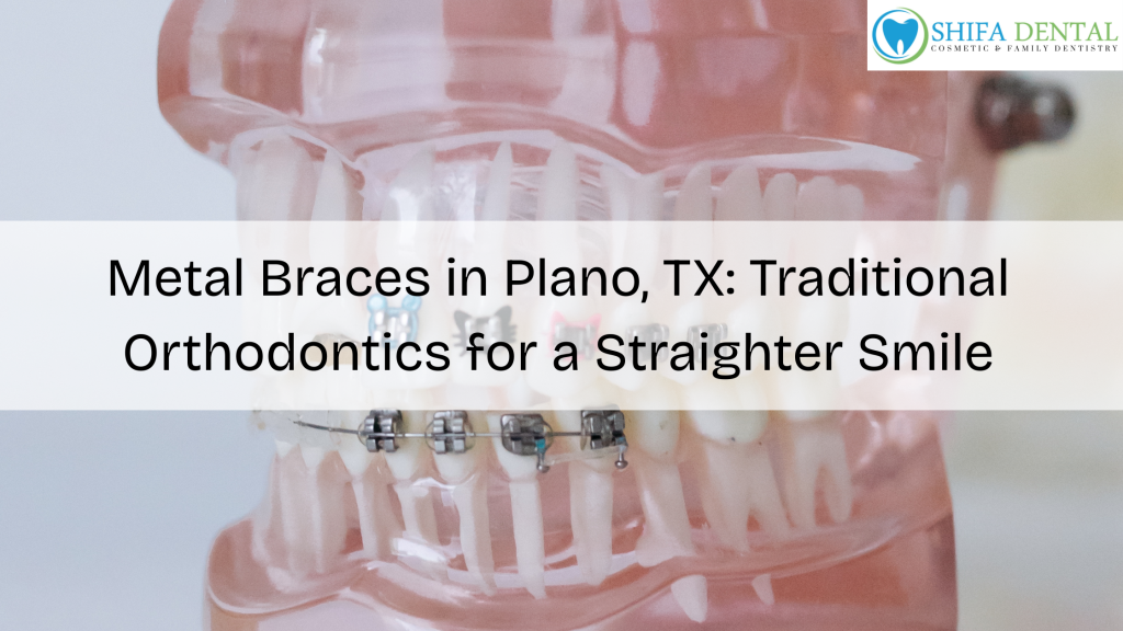 Metal Braces in Plano TX