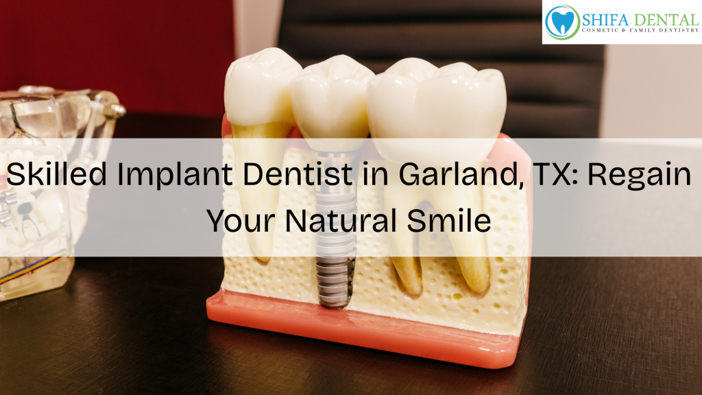 Implant Dentist in Garland TX