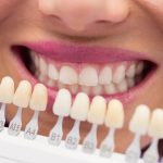 dental-crowns-in-plano-tx