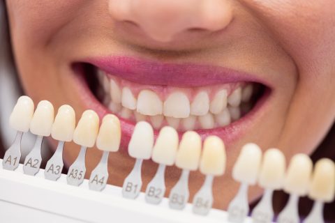 dental-crowns-in-plano-tx