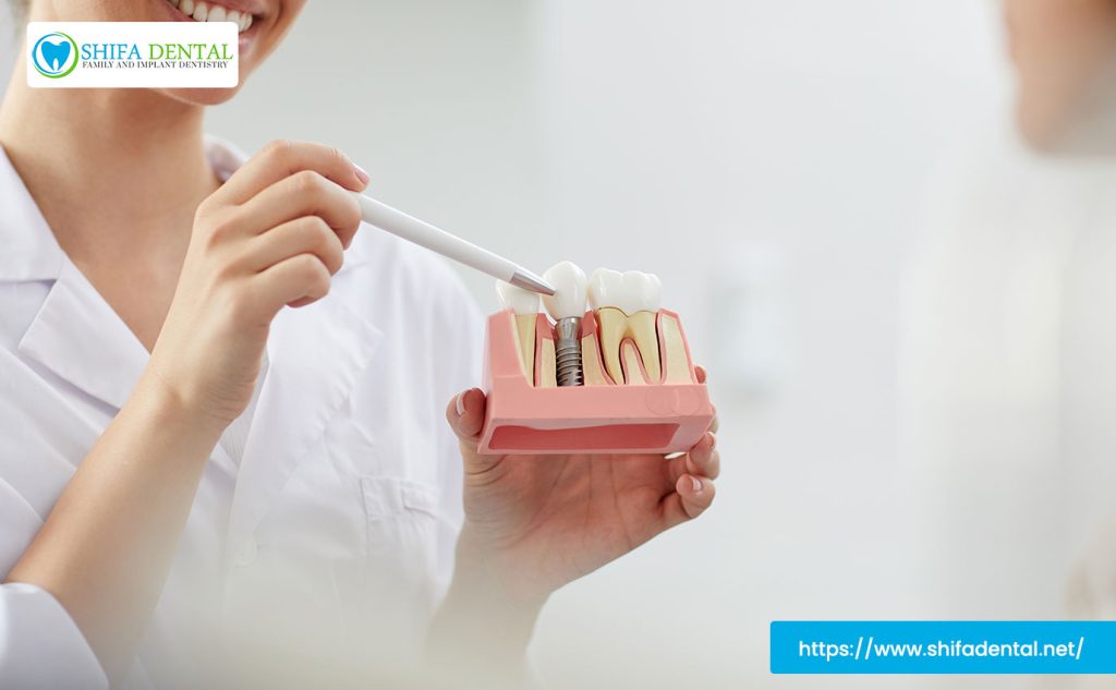 dental-implants-near-me-plano-tx