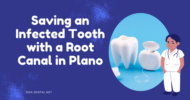Saving an Infected Tooth with a Root Canal in Plano
