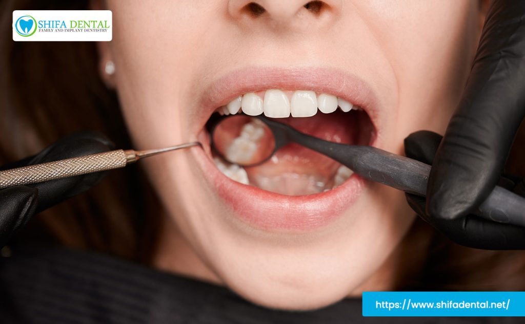 dental-extraction-process