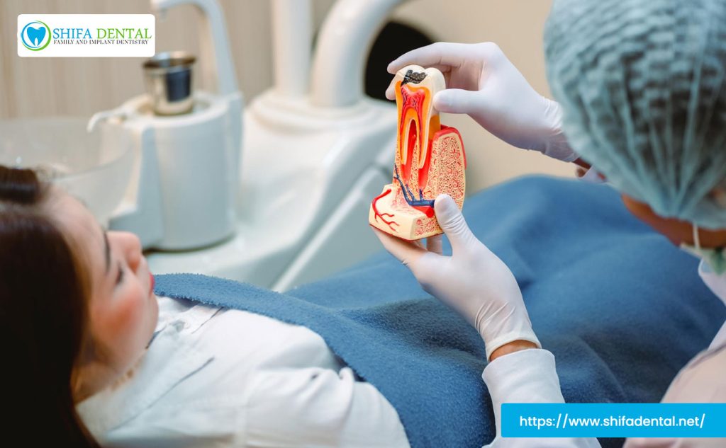 root-canal-specialist-plano