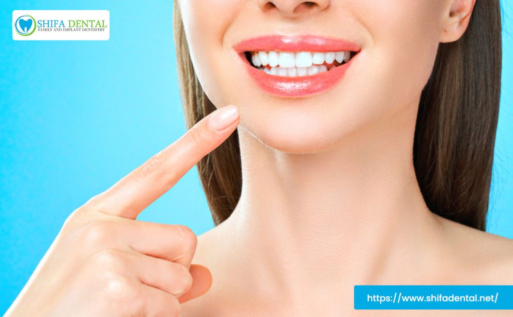 teeth-whitening-benefits