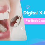 Digital X-Ray for Root Canal Plano TX