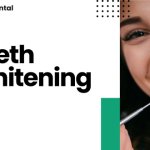 What Is Teeth Whitening?