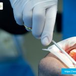best dentist in plano