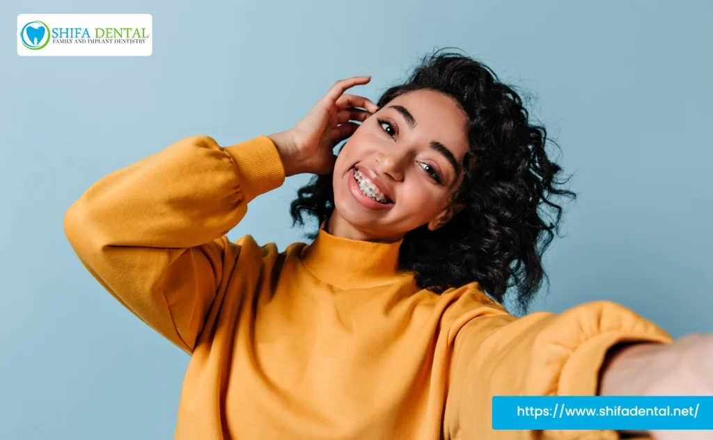 Invisalign for Crossbite