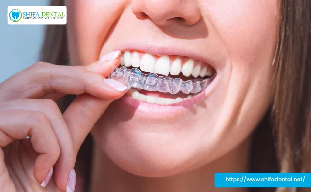 Invisalign for Crossbite Plano TX