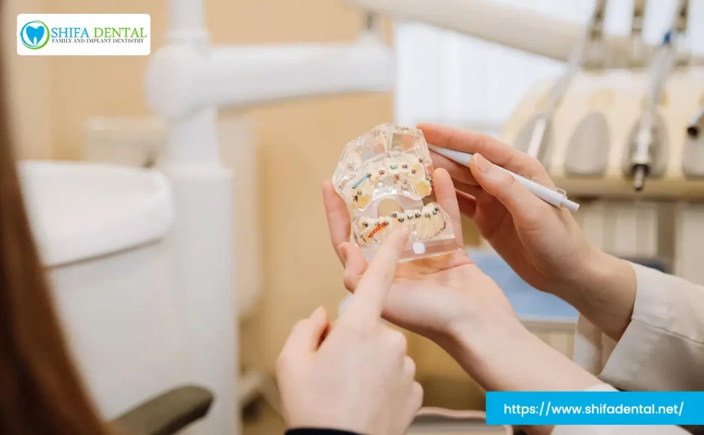 braces cost plano