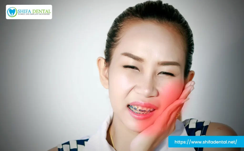 braces pain
