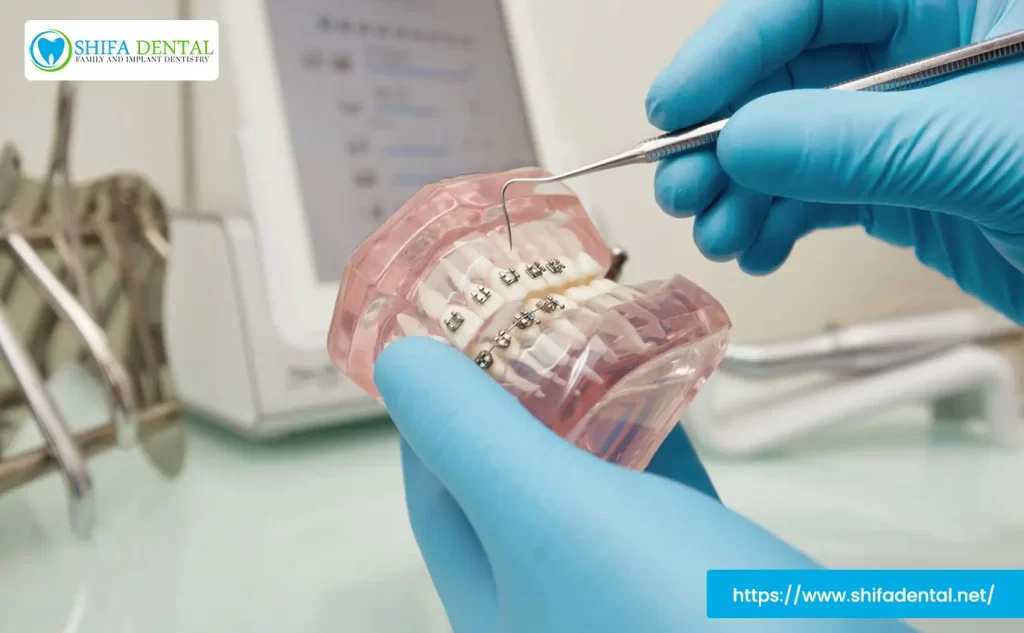 dental braces treatment