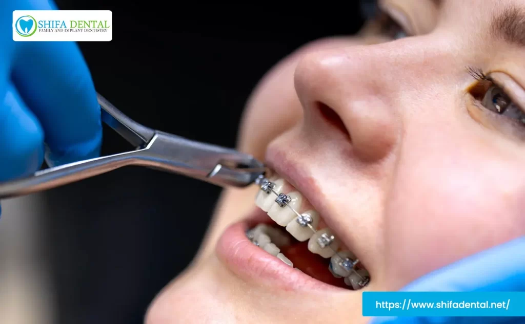 pain with braces