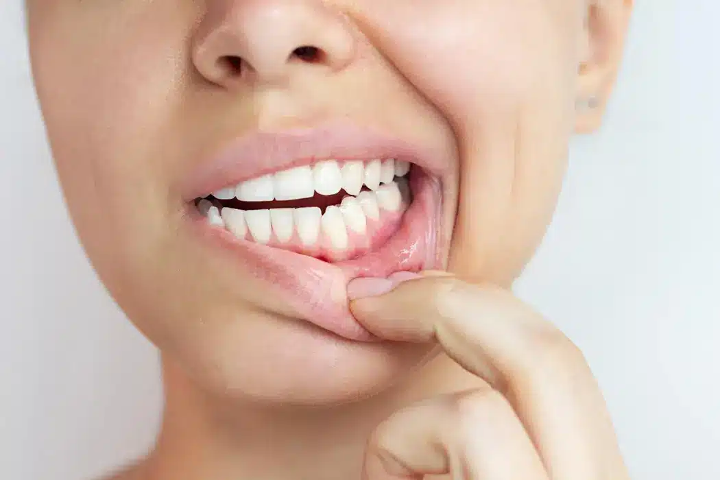 Affordable Periodontal Therapy Near Me