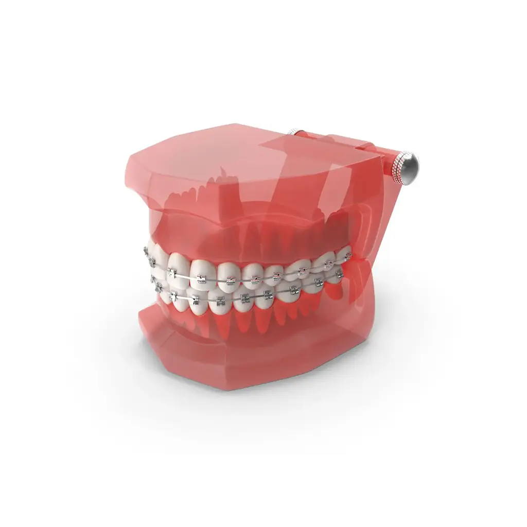 Steel Braces For Teeth