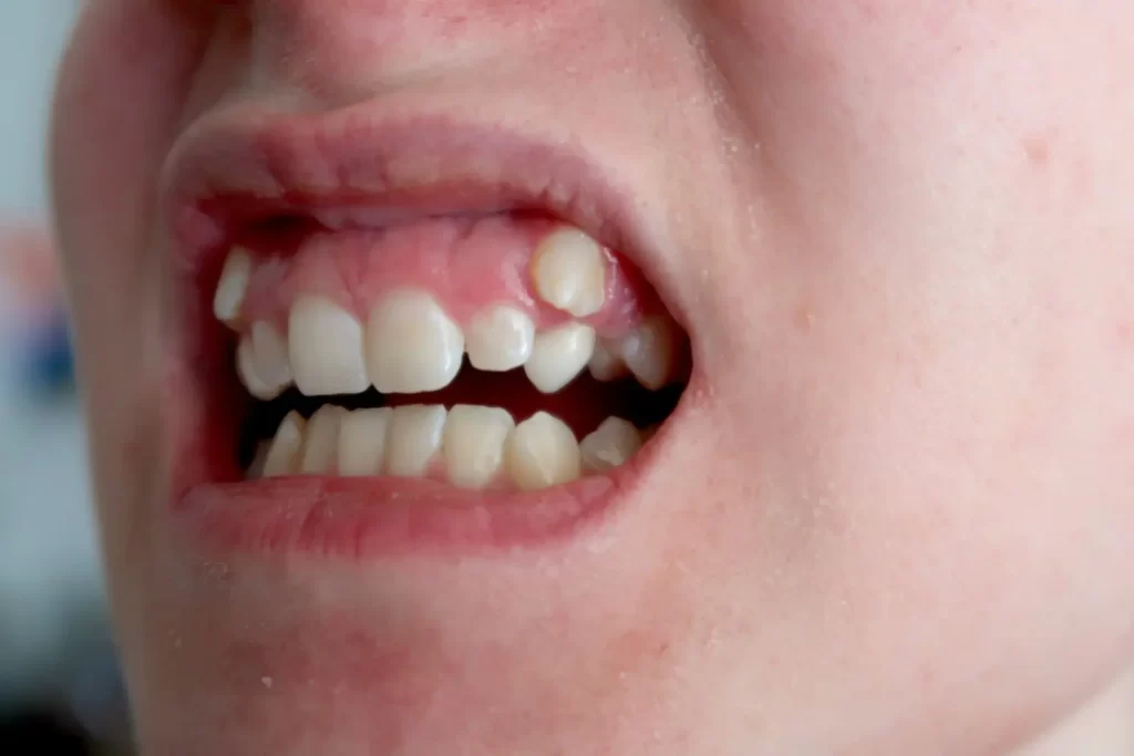 Cosmetic Dental Services