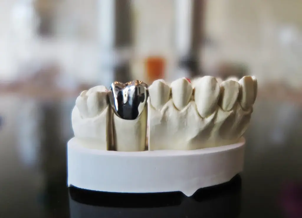 Dental Crowns Plano TX