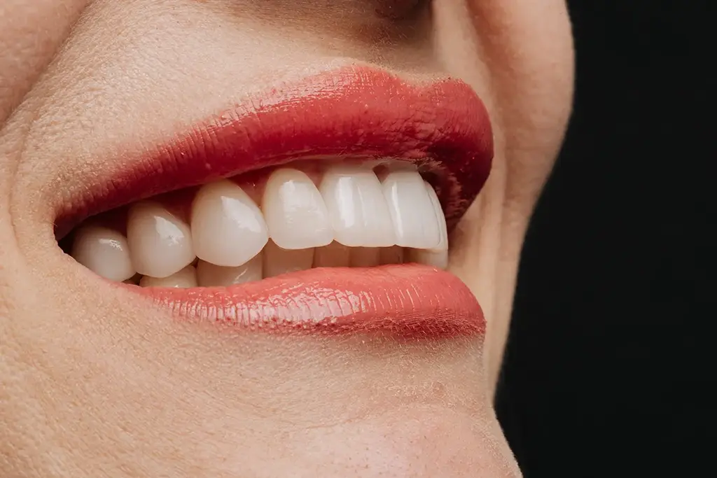 Plano Porcelain Veneers