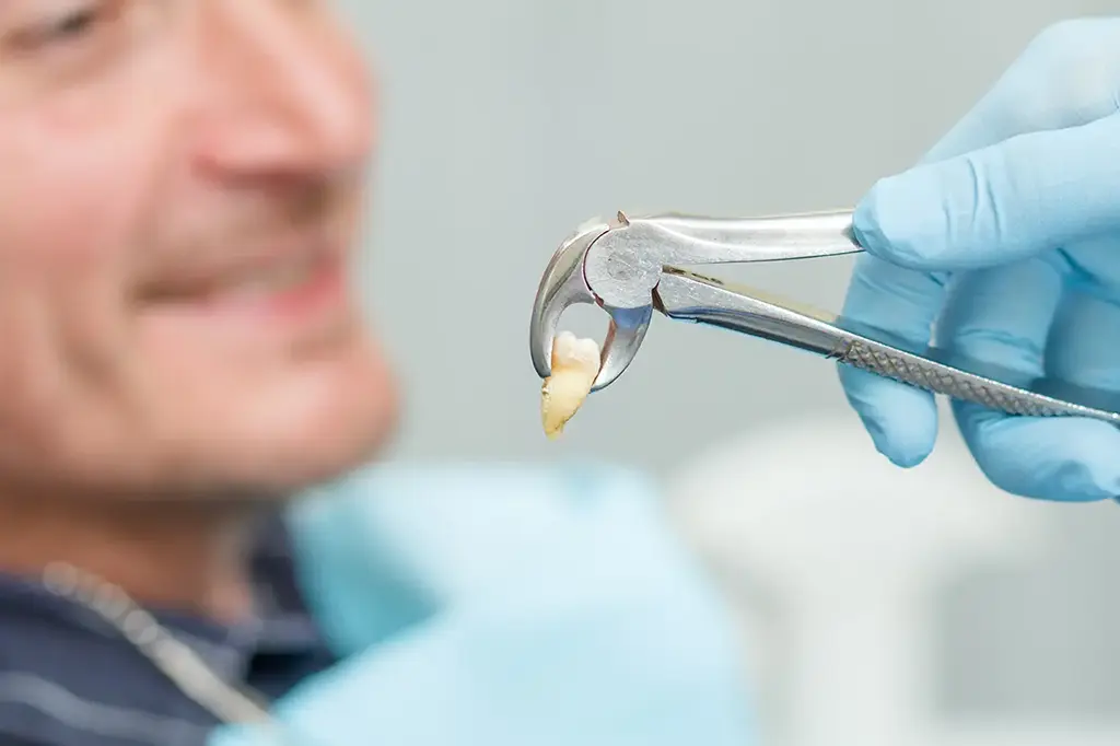 Emergency Dental Extractions Plano