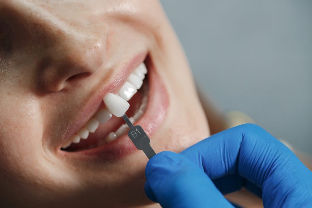 Dental Implants in Garland
